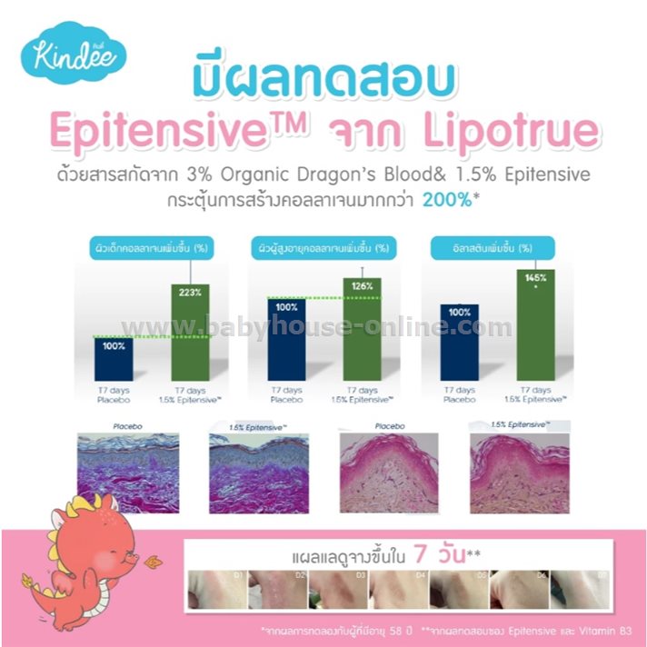 Kindeeเจลทาแผลเป็นสำหรับเด็ก